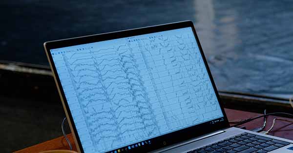 STEM. Dans și Neuroștiință 01